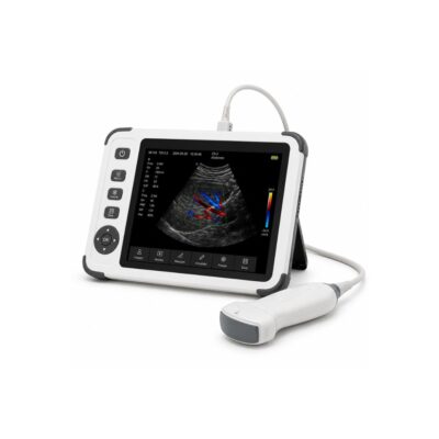 Handheld Colour Doppler Ultrasound Diagnostic System